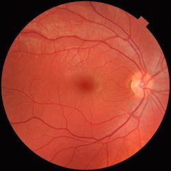 Fundus – LearnOpenCV Fundus