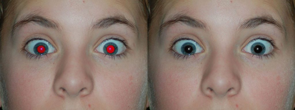 automatic-red-eye-removal-2 – LearnOpenCV Automatic Red Eye Removal Example