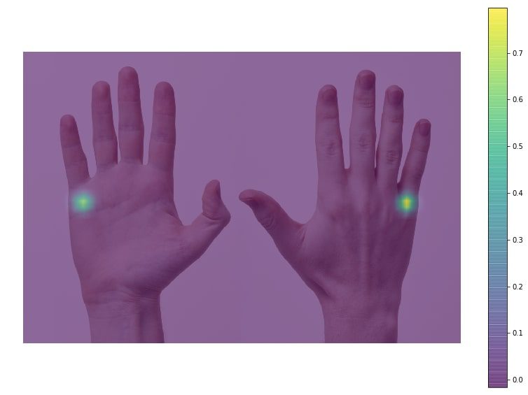 handpose-heatmap-little – LearnOpenCV Image with probability heatmap for base of little finger superimposed on original image.